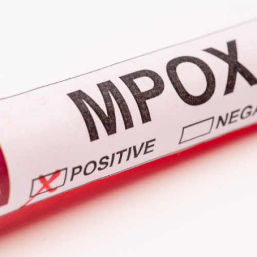 OMS declară mpox, o urgență de sănătate publică globală